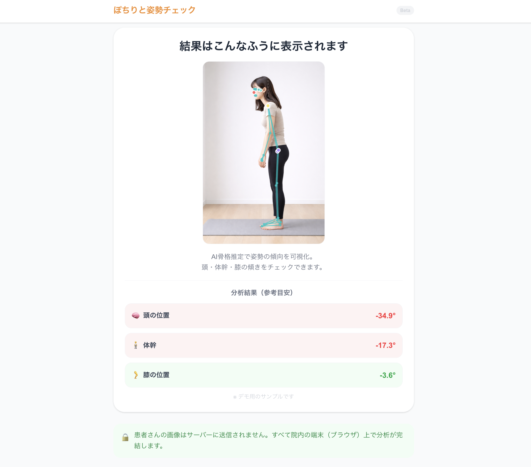 ぽちりの姿勢チェックで姿勢の傾向を可視化した画面