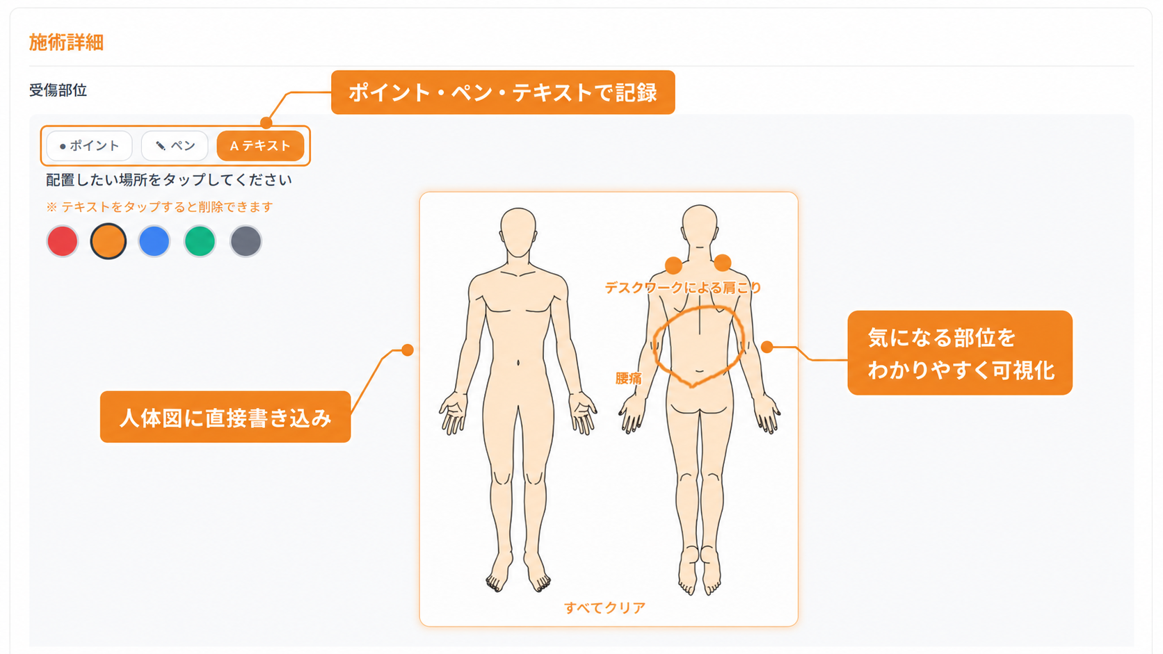 人体図に直接記録