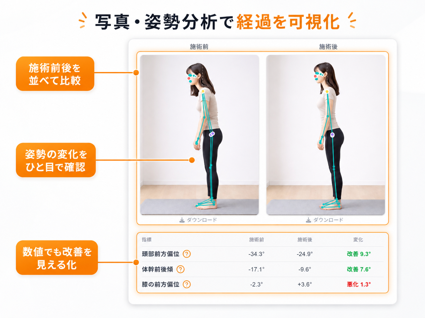 写真・姿勢分析で経過を可視化